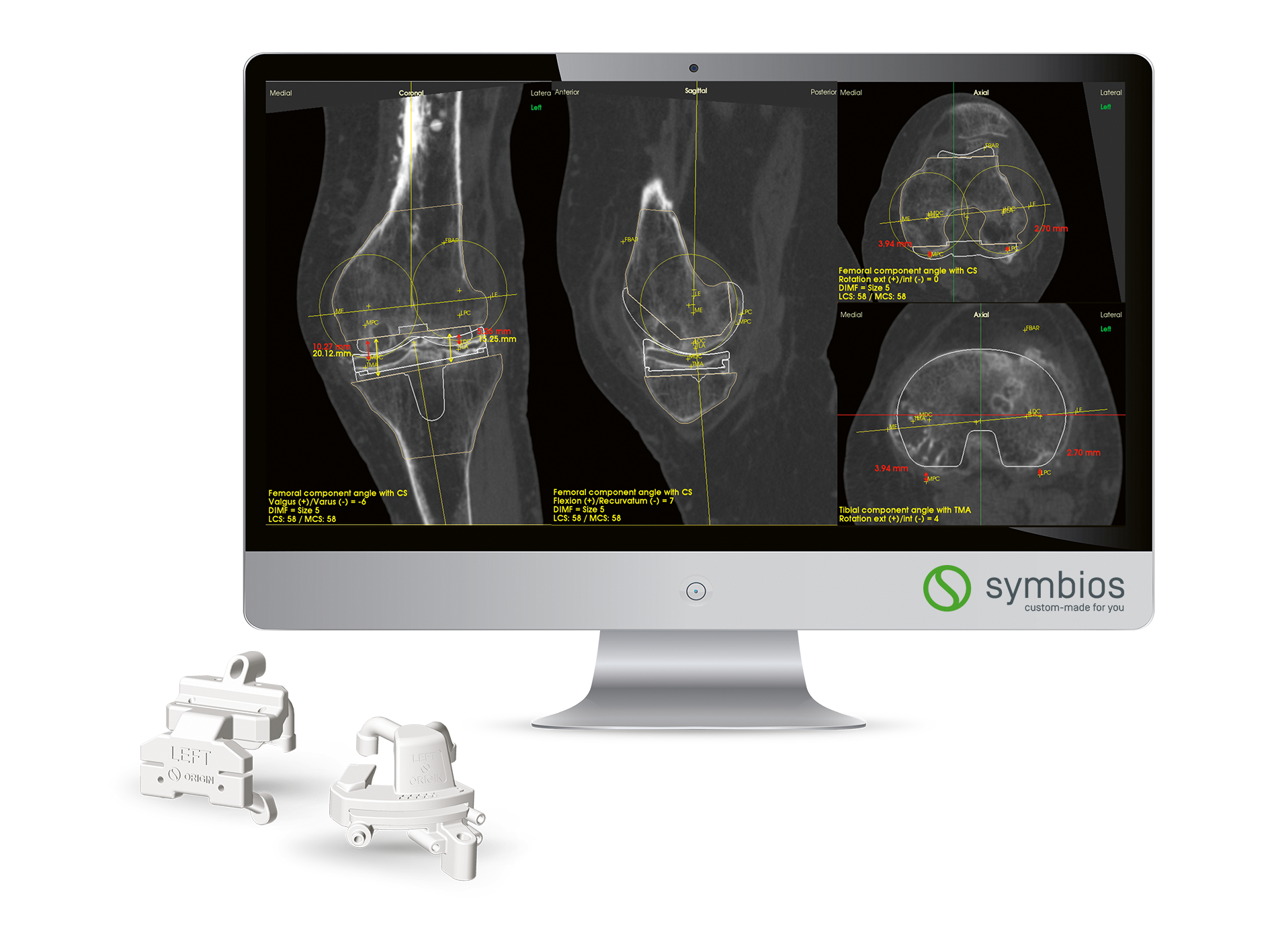 Origin · Knee System aanvullend beeld